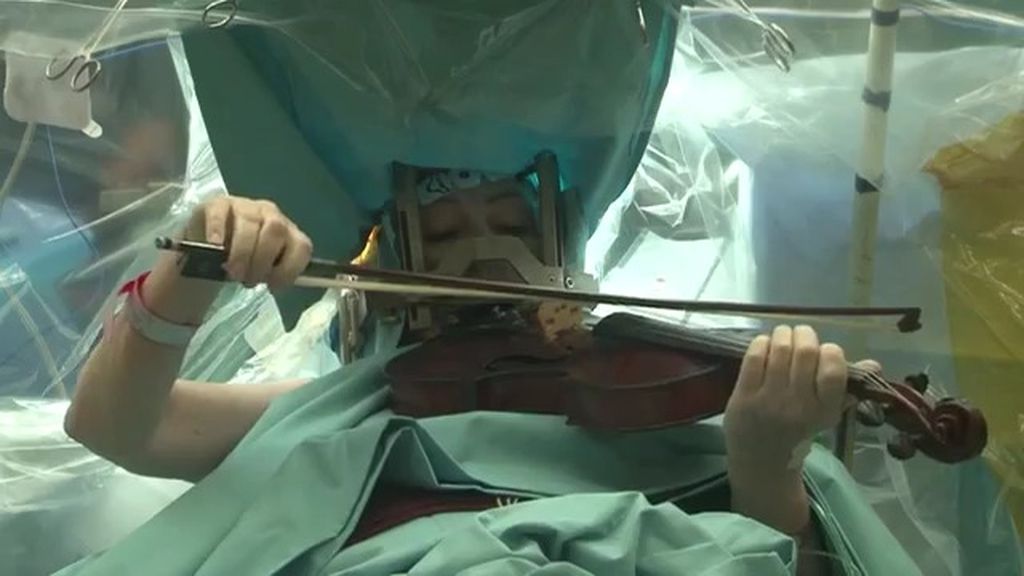 Una violinista toca el violín mientras la operan del cerebro