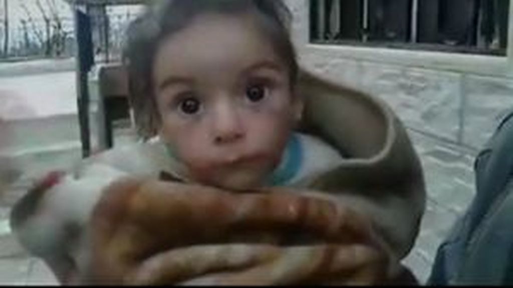 Los ojos de esta niña, la imagen del hambre y la desnutrición en Siria