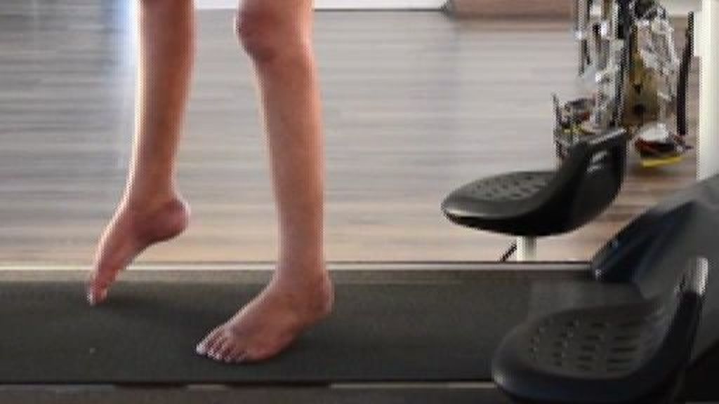 Ocho parapléjicos recuperan el control de sus piernas... tras usar exoesqueletos