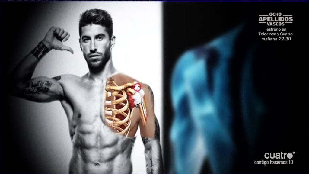 Sergio Ramos y su hombro lesionado: ¿otra infiltración para llegar al clásico?