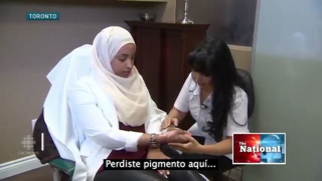 Tatuajes contra la cicatrices