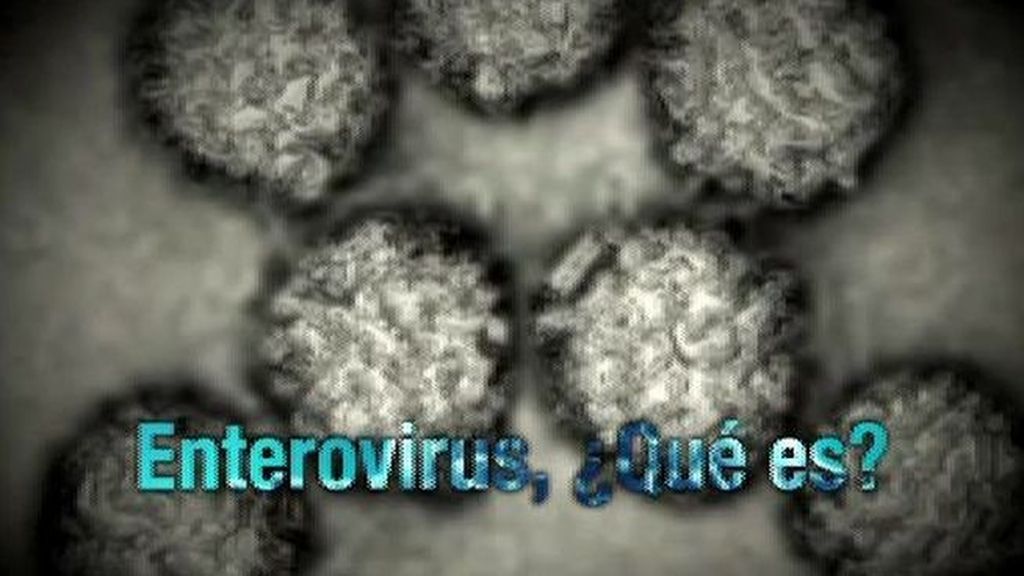 Todo sobre el enterovirus