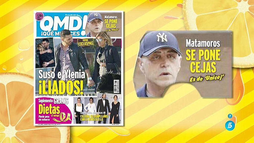 Así son las nuevas cejas de Kiko Matamoros