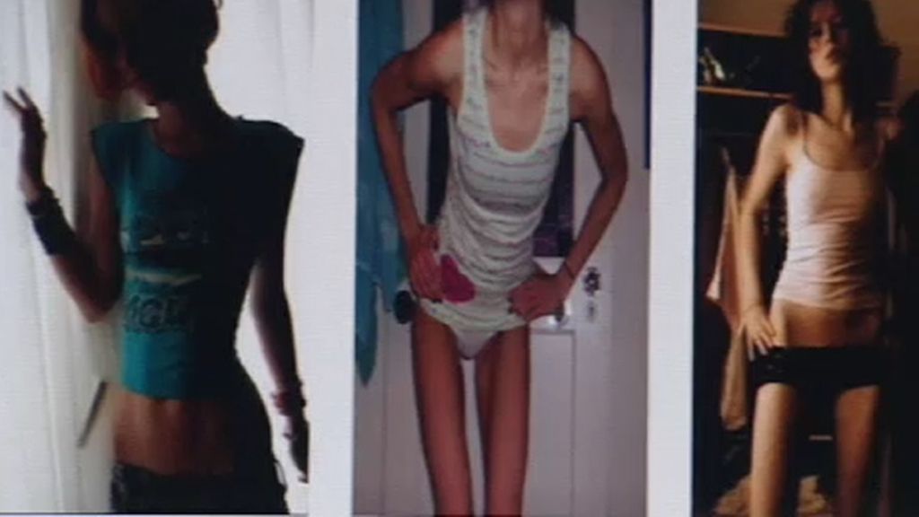 Francia declara la guerra a la anorexia