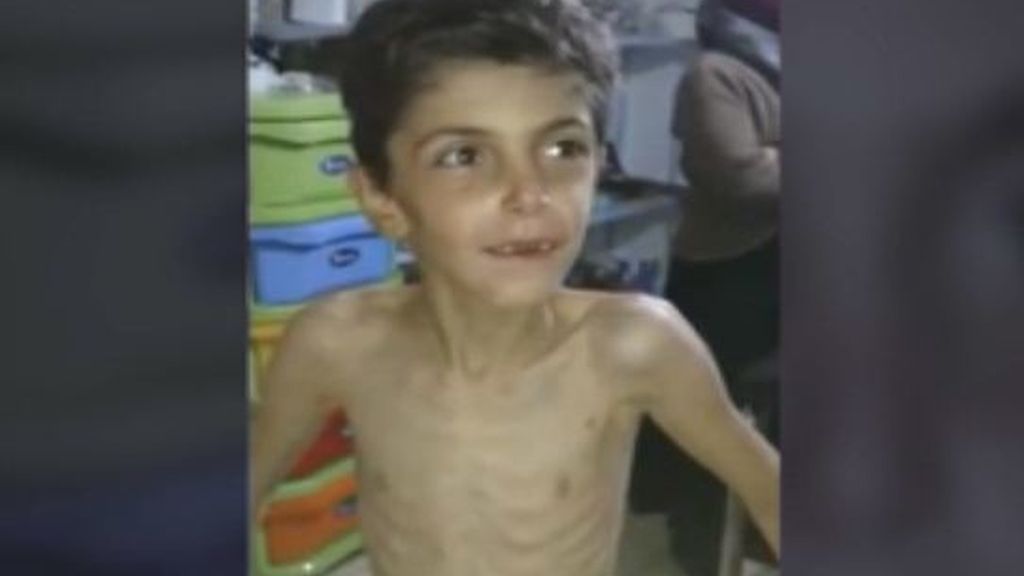 Niños sirios muertos de hambre
