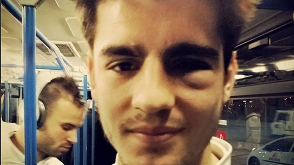 El sufrimiento de Morata: fuerte golpe en un ojo, se desplomó y terminó vomitando