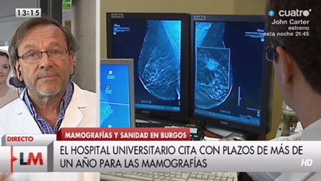 El Hospital Universitario de Burgos cita con plazos de un año para las mamografías