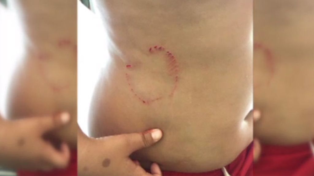 En Benidorm no hay tiburones