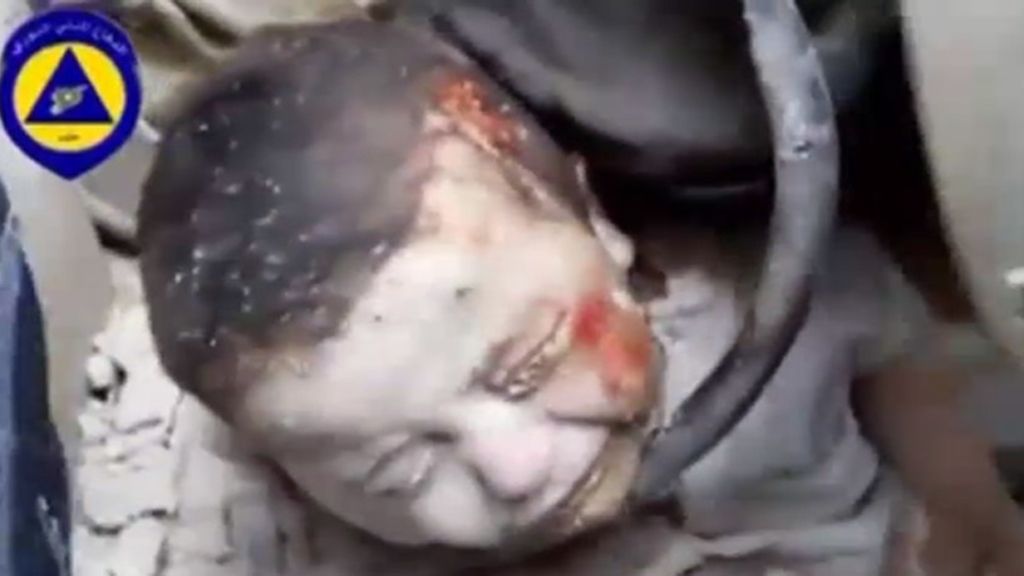 Rescatan a un niño sumergido entre los escombros tras un bombardeo