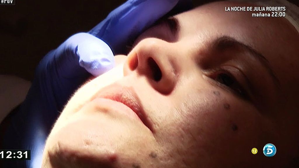 Isabel comienza con los tratamientos para perder peso