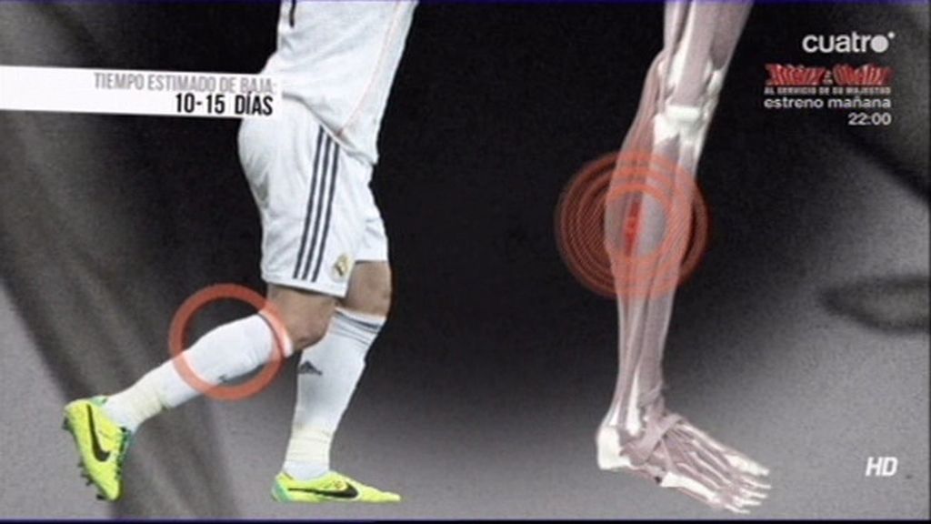 La lesión en el sóleo de Sergio Ramos requiere cautela y tiempo de recuperación
