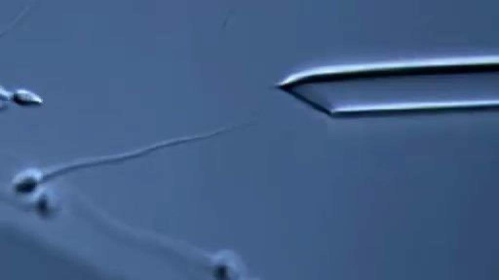 Espermatozoides de laboratorio para paliar la infertilidad masculina