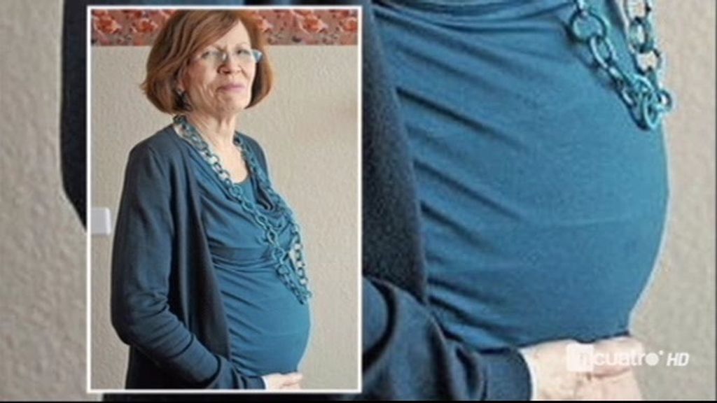 Embarazada de cuatrillizos a los 65 años