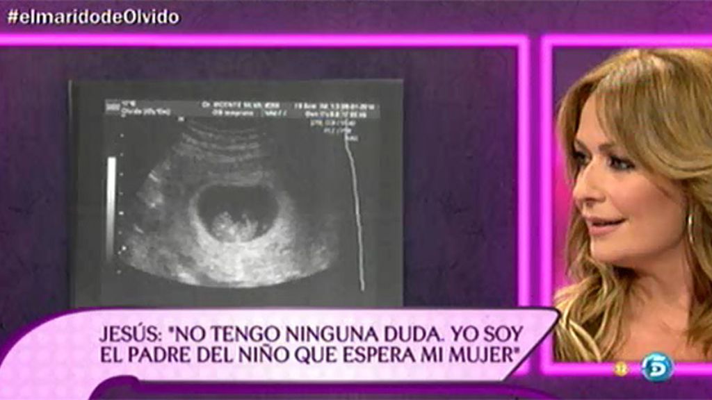 En exclusiva, la ecografía del bebé que esperan Olvido Hormigos y Jesús Atahonero