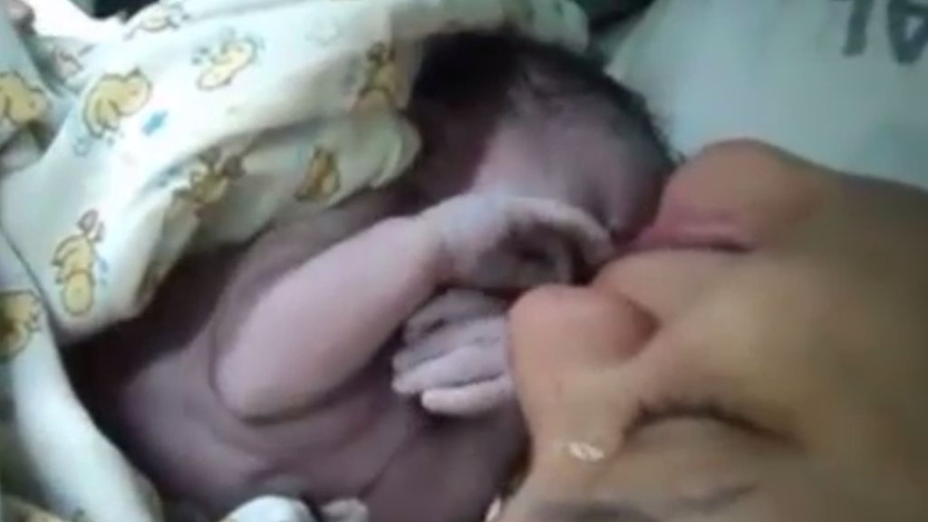 Un bebé que llora desconsolado nada más nacer cuando lo separan de su madre