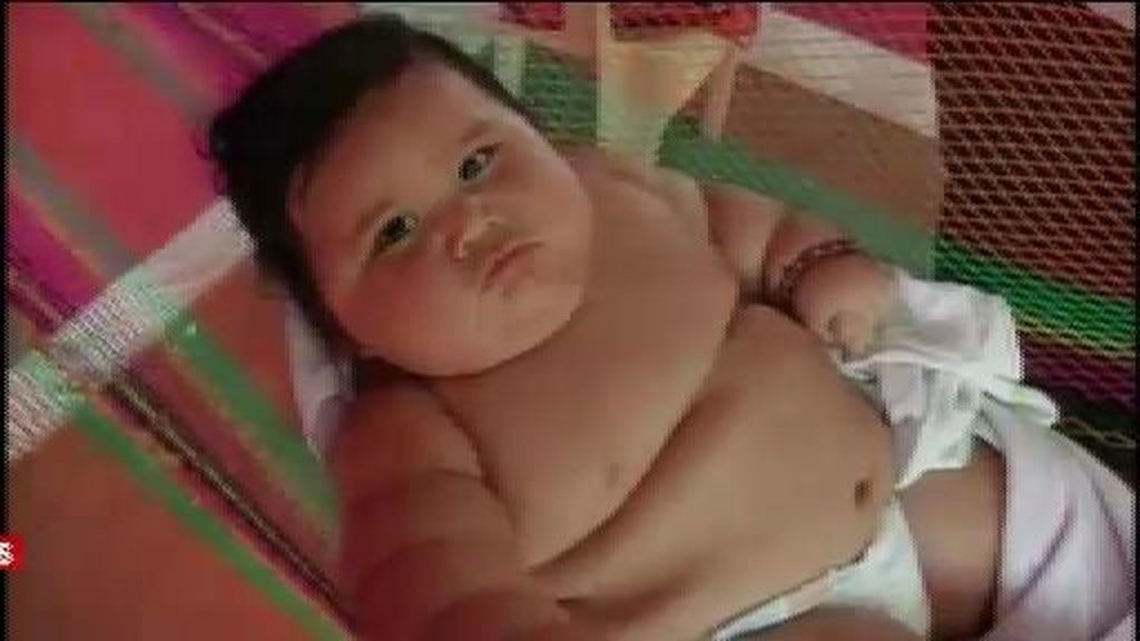 Un bebé colombiano pesa más de 20 kilos con ocho meses de vida