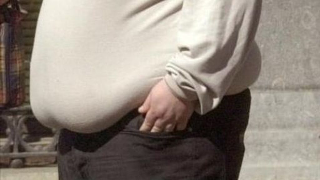 La obesidad, culpa de nuestros genes