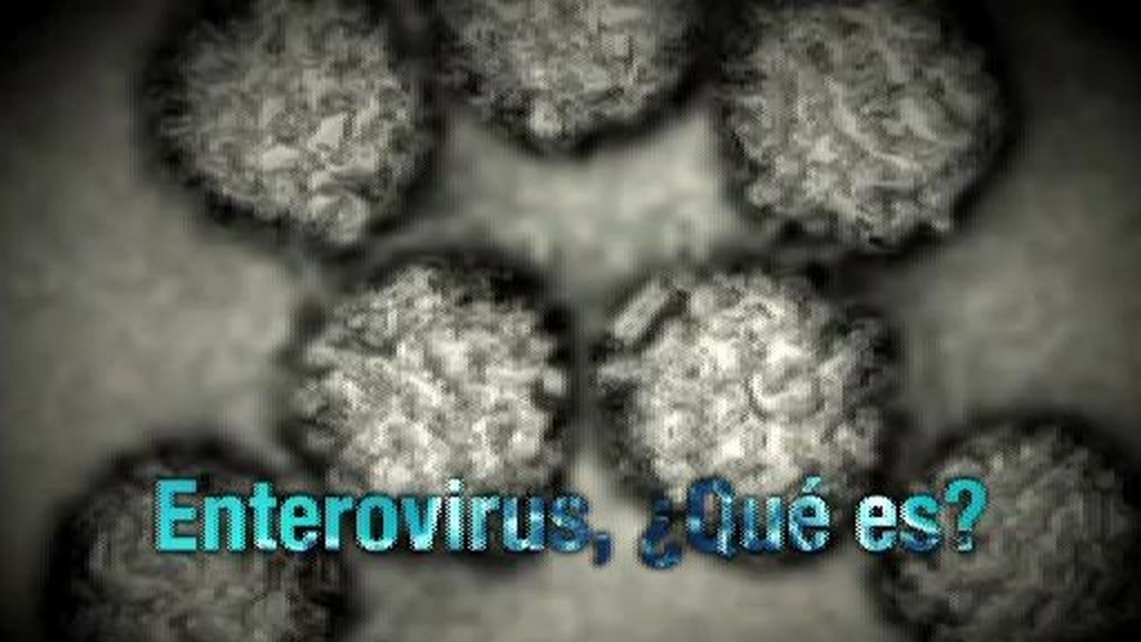 Todo sobre el enterovirus