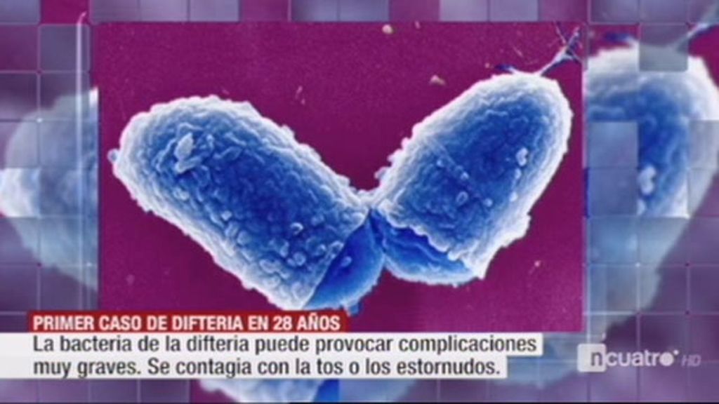 Un niño no vacunado, primer caso de difteria en España en casi 30 años