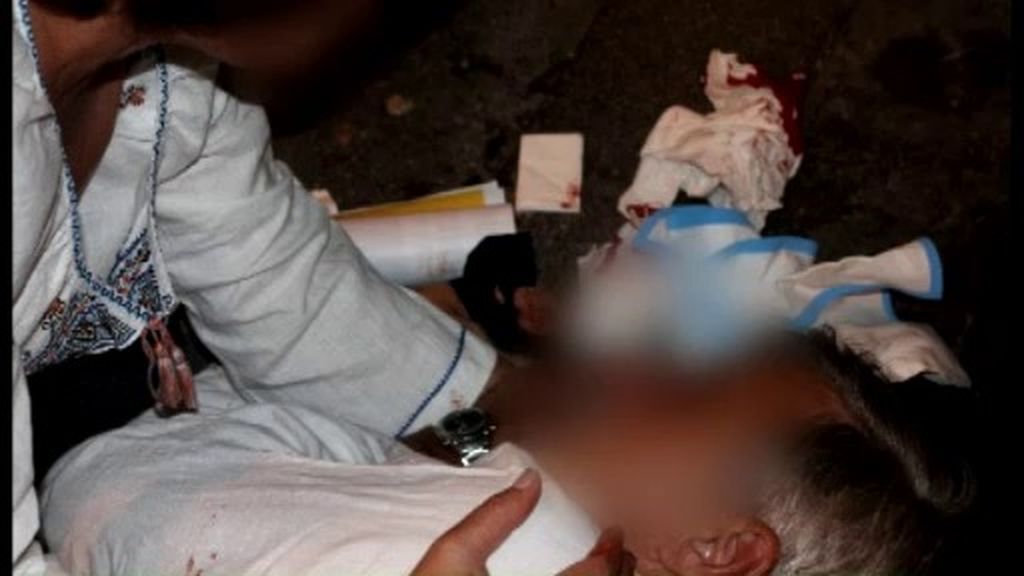 Brutal paliza a varios ucranianos en Barcelona