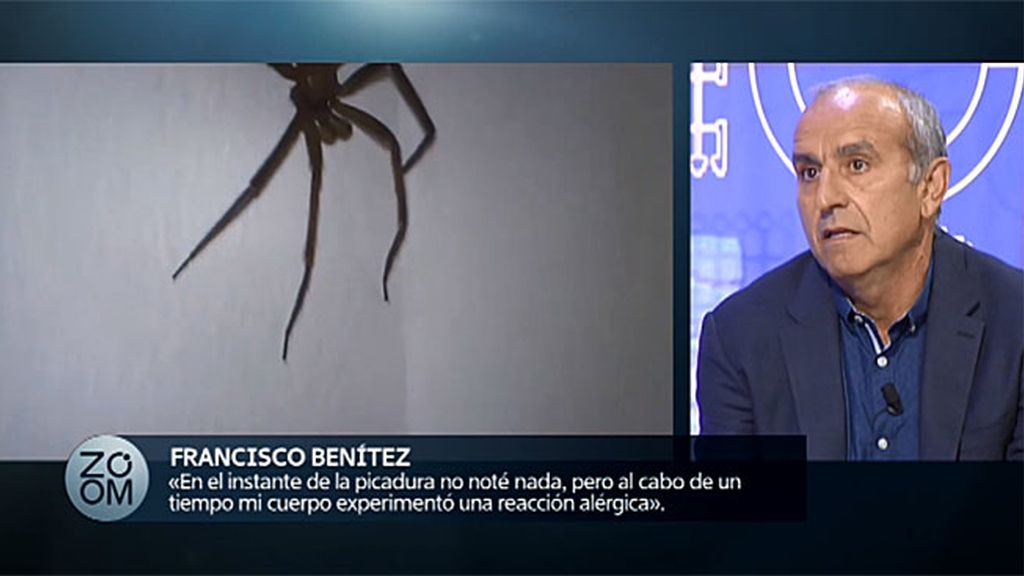 El terrible testimonio de un afectado por la picadura de una araña, en 'Zoom'