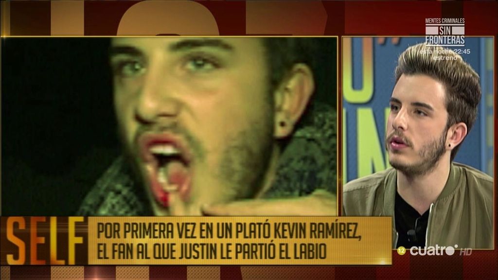 Kevin, víctima de Justin Bieber: "Ha dejado de ser un ídolo para mí"