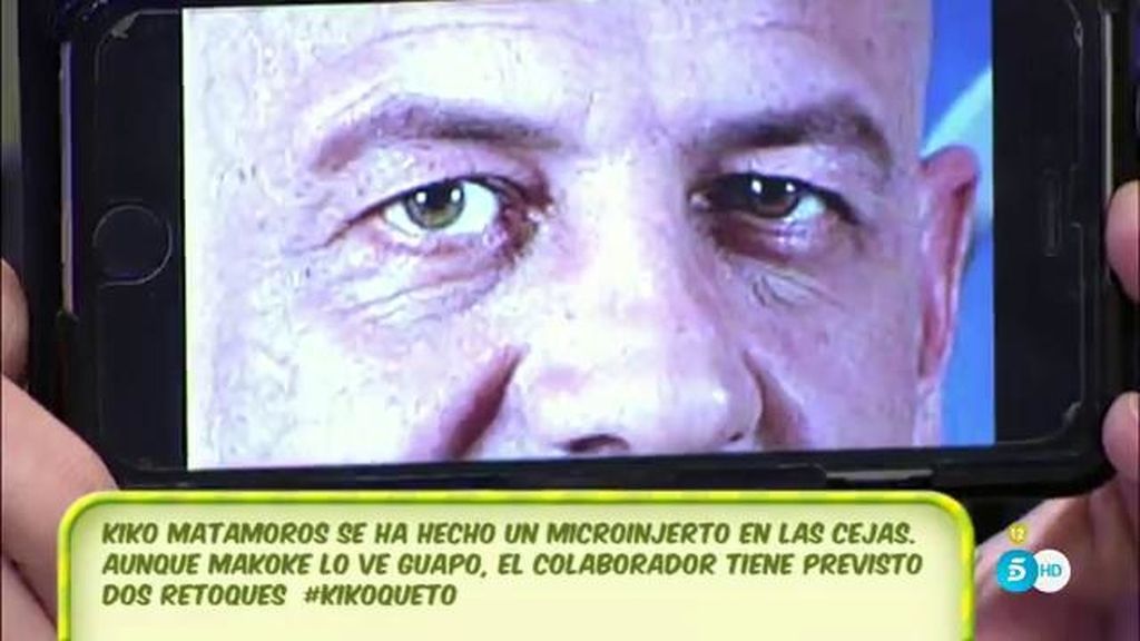 Así eran y serán las cejas de Kiko Matamoros