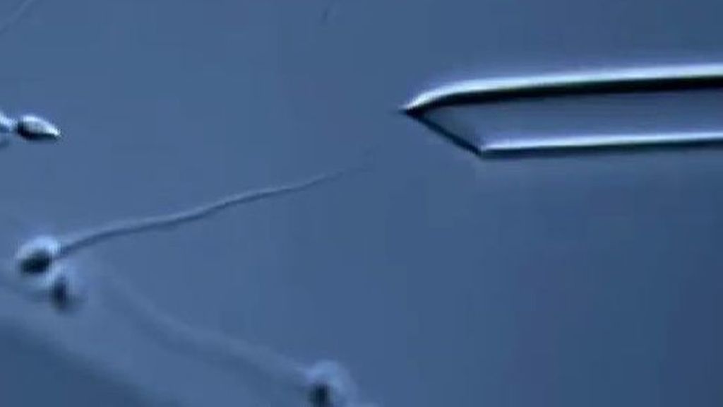 Espermatozoides de laboratorio para paliar la infertilidad masculina