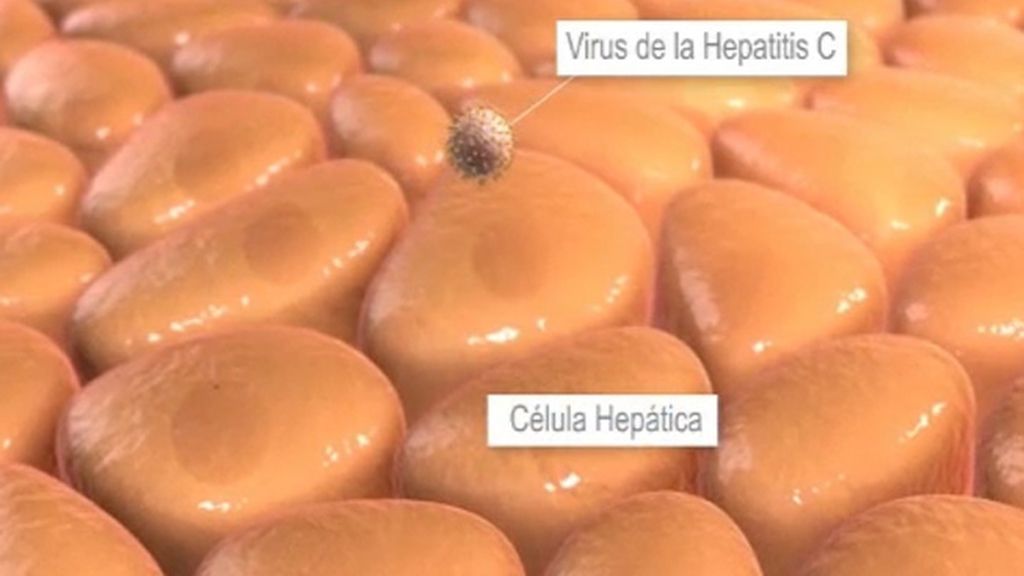 Enfermos de Hepatitis C demandarán a Sanidad
