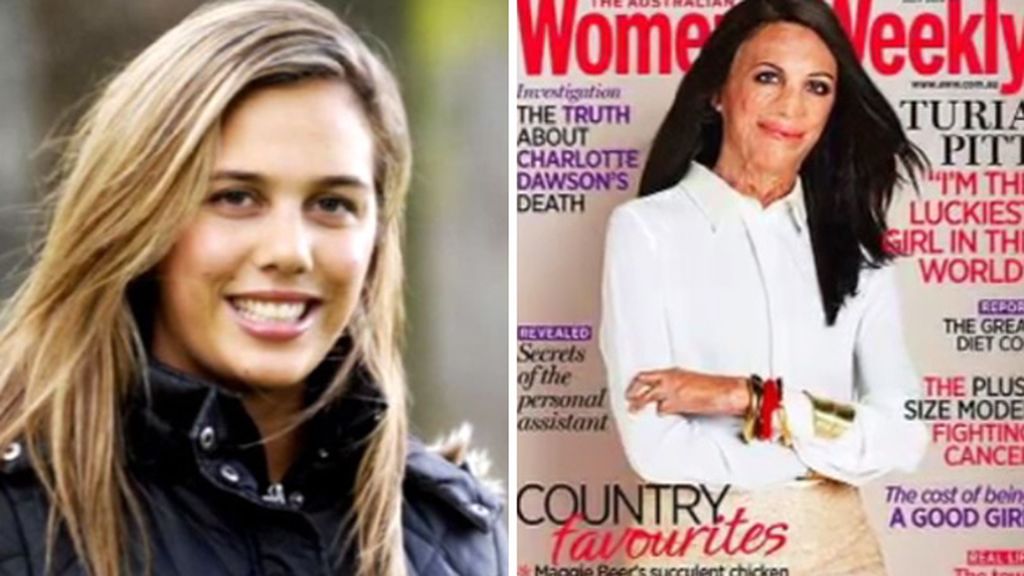 Turia Pitt: "Soy la chica más afortunada del mundo"