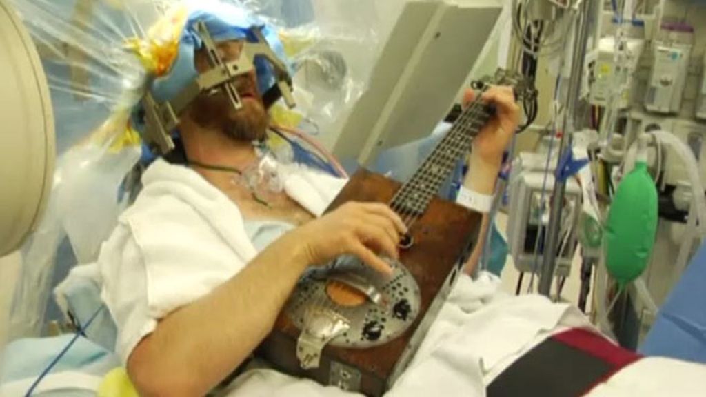 Un músico toca la guitarra mientras le operan el cerebro