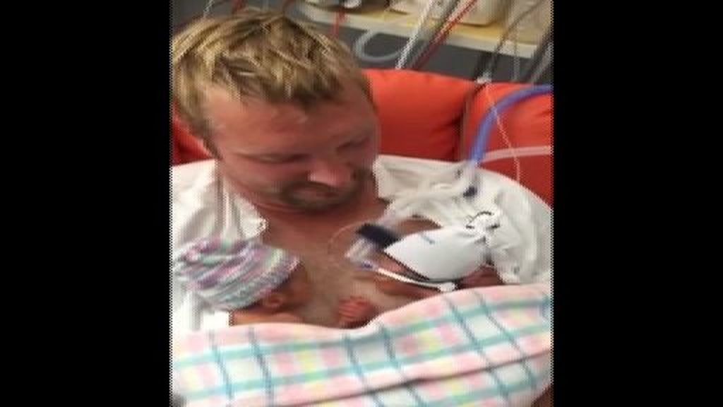 Dos gemelos prematuros se dan la mano horas después de haber nacido