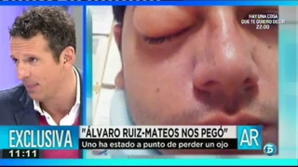Una amiga de Álvaro Ruiz - Mateos asegura que le dijeron que la iban a violar