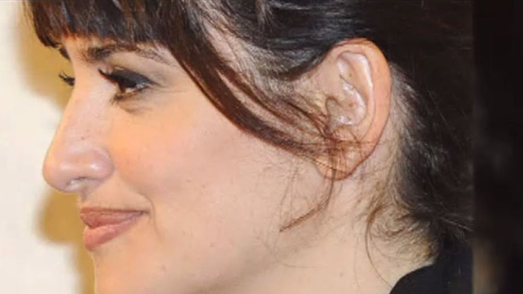 "Aurículoterapia", la última moda entre los famosos