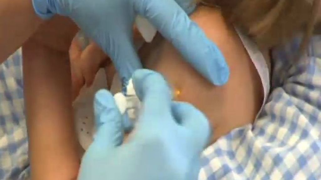 Sanidad dice que la falta de vacunas de varicela en las farmacias no amenaza la salud
