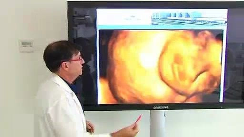 Operado con éxito un feto con un tumor de grandes dimensiones