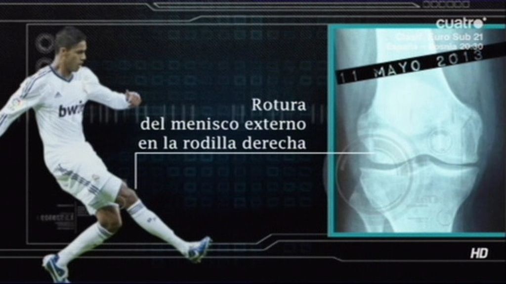 Varane se resiente de su lesión de rodilla