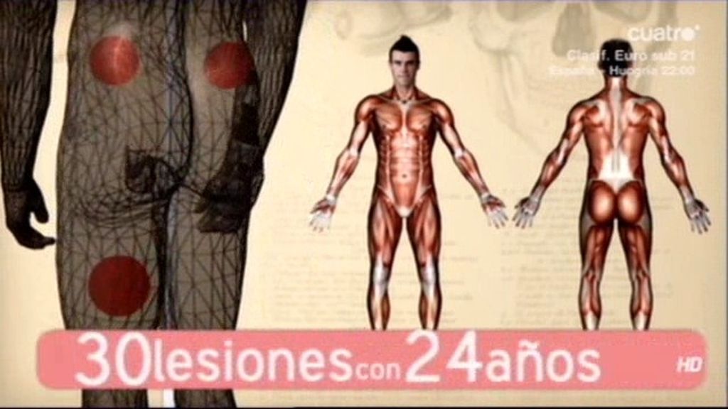 Las lesiones de Bale hasta la fecha