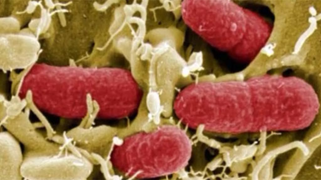 ¿Qué es la E-coli?