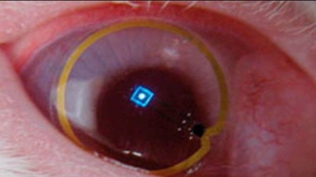 Lentillas que convierten el ojo humano en pantallas de ordenador