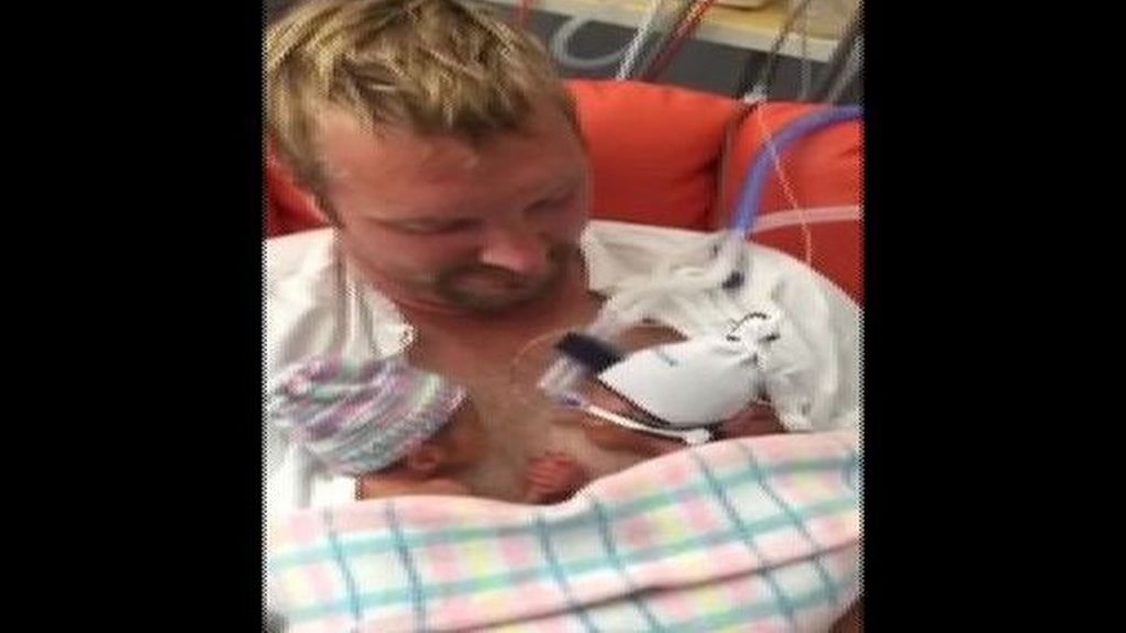 Dos gemelos prematuros se dan la mano horas después de haber nacido