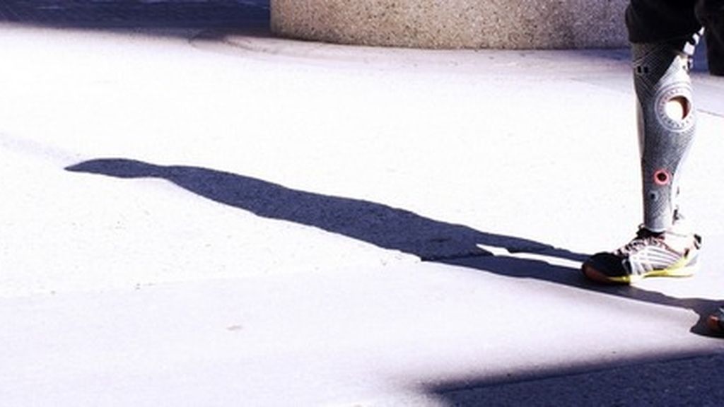 Moda y prótesis, de la mano