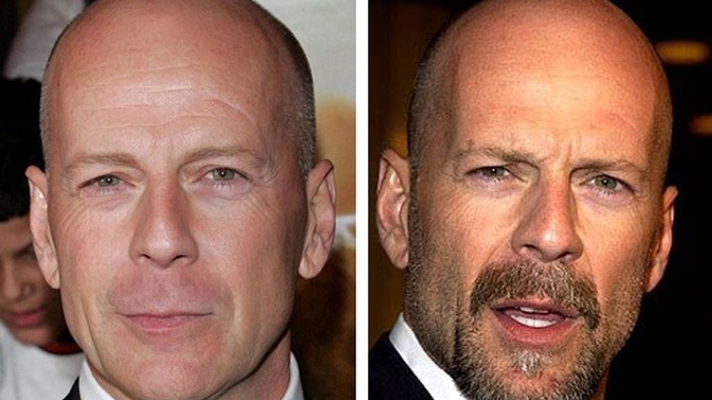 Los famosos, mejor sin barba