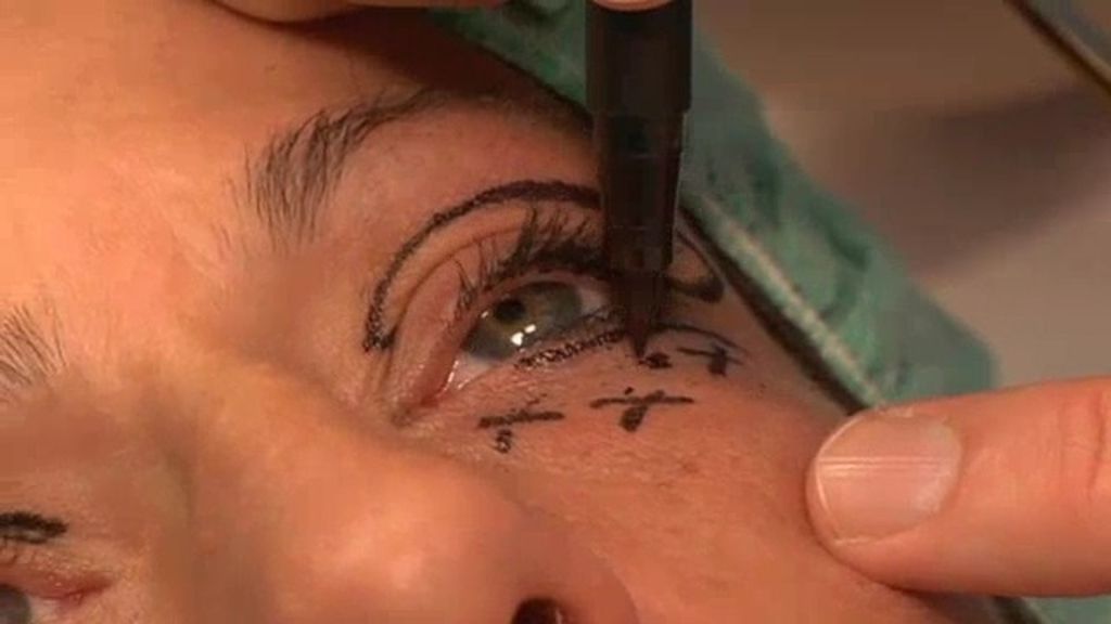 Las mejores fotos de 'Belleza de bisturí'