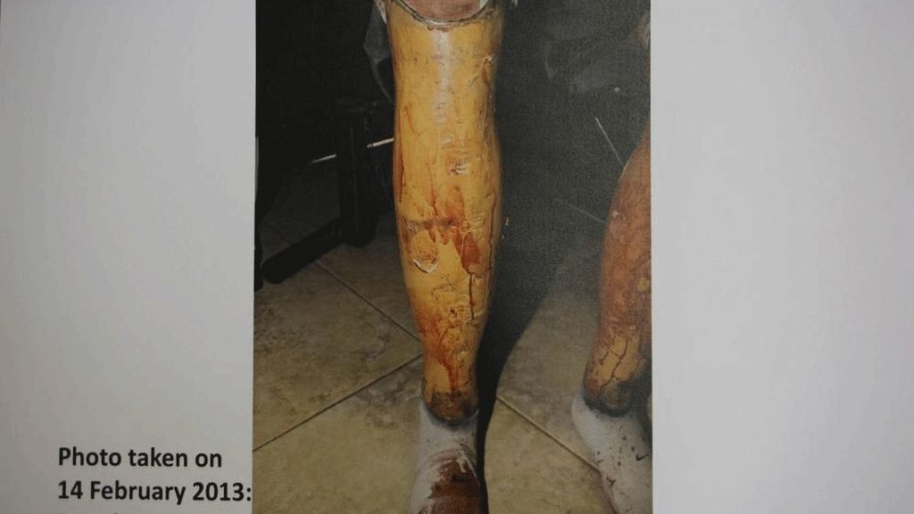 Las imágenes que incriminan a Oscar Pistorius