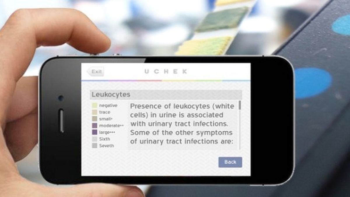 Analiza la orina con tu smartphone
