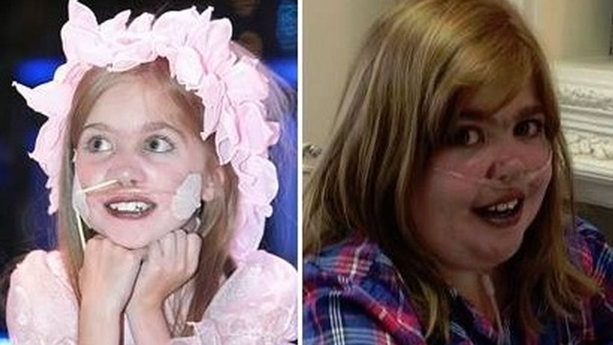 Muere la joven Kirsty Howard, tras años de lucha contra su extraña condición
