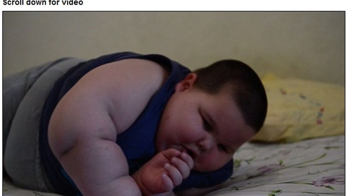 Un niño de solo tres años pesa ya casi 70 kilos