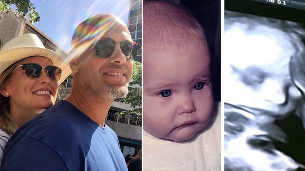 Bar Rafaeli ya le saca parecidos y compara la eco con una foto suya de bebé