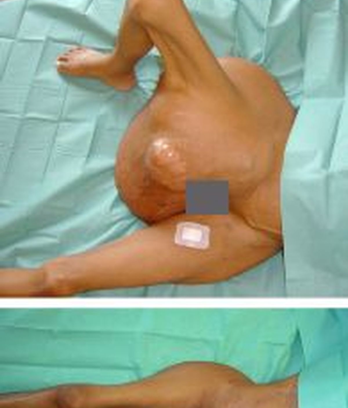 Imagenes facilitadas por la clínica Capital Health Group, que muestra el antes y el después de la intervención. Foto:EFE